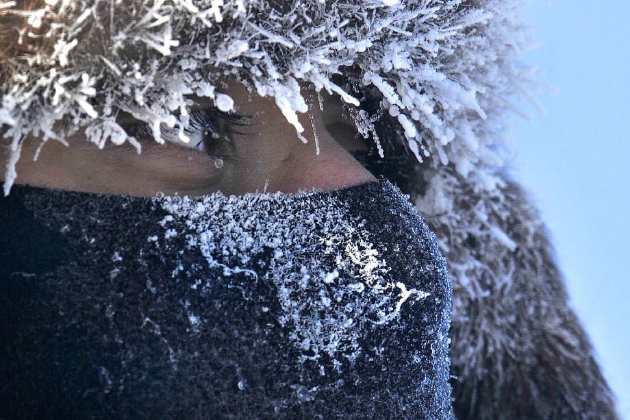 Prendre soin de sa peau en hiver